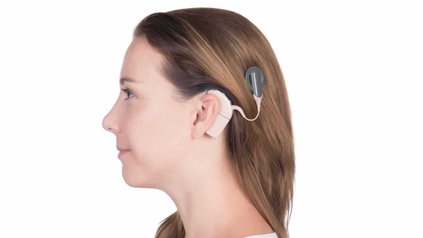 Cochlear Implants